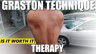 Graston Technique Muscle Scraping  MY EXPERIENCE [upl. by Evanthe331]