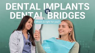 Implant vs Bridge Which Is Right for You [upl. by Higley]