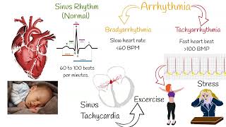 Tachycardia  Most Common causes and Symptoms [upl. by Lyrac]