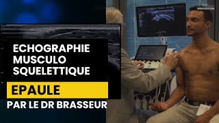 EPAULE  Echographie Musculo squelettique par le Dr Brasseur [upl. by Nnylannej]