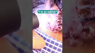 😱Foliculitis decalvante 3 tratamientos y conoce más dermatólogo Tricólogo militar [upl. by Aelahs280]