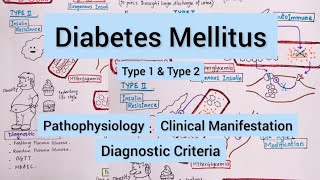 Diabetes Mellitus Type 1 amp Type 2 [upl. by Bartholemy]