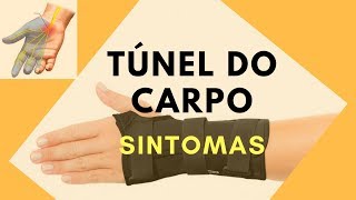 Síndrome do Túnel do Carpo  Eletroneuromiografia e Sintomas [upl. by Letnwahs]