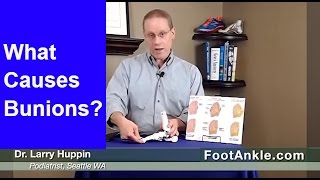 What Causes Bunions  Seattle Podiatrist Dr Larry Huppin [upl. by Rhys]