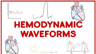 Hemodynamic Waveforms Made Simple [upl. by Raouf]