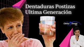 Dentaduras Postizas Ultima Generación Dentaduras con implantes Clínica Dental Velez [upl. by Iatnwahs210]