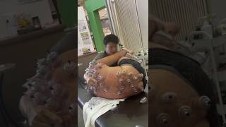 CRAZIEST Bodywork I’ve Ever Seen 😳 Reaction To Cupping Therapy massage mobility cupping [upl. by Nnyleahs]