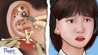 ASMR Oddly Satisfying Ear Blackhead Ear Swelling And Sebaceous Cyst Removal Animation  Stop Motion [upl. by Yahs]