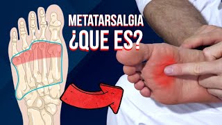 🦶🏻 Que es la METATARSALGIA causas sintomas y tratamiento [upl. by Nogem]