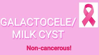 Galactocele Milk Cyst  Diagnosis Ultrasound Mammography amp Treatment Breast Cancer Awareness [upl. by Erasmus556]