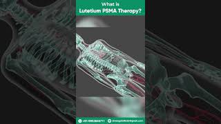 What is Lutetium PSMA TherapyLu 177 PSMA Lutetium PSMA Prostate Cancer Therapy shorts [upl. by Elreath94]