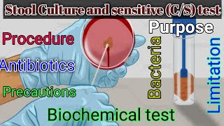 Stool Culture and Sensitivity test  Stool for CS [upl. by Spitzer159]