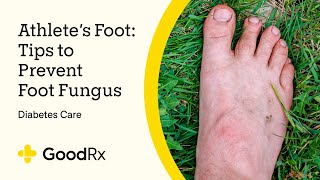 Diabetes and Athlete’s Foot What a Podiatrist Needs You to Know  GoodRx [upl. by Anilas313]