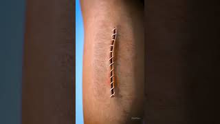 Wound healing process 3D video Shorts shorts shortsfeed funny [upl. by Manson65]