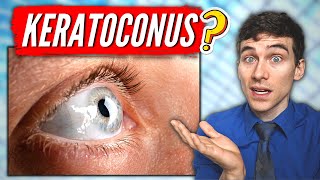 What is Keratoconus Keratoconus Eye Disease Explained [upl. by Aihsik]