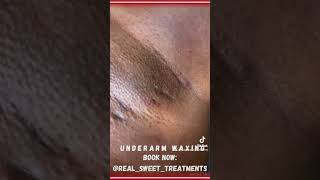 Underarm Waxing summer wax skincare facial [upl. by Nathanson507]