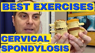 4 Best Exercises for Cervical Spondylosis  Dr Walter Salubro Chiropractor in Vaughan ON [upl. by Petey311]