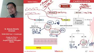 CARDIO  Arritmias Cardíacas  ENAM 2020 [upl. by Lalage709]