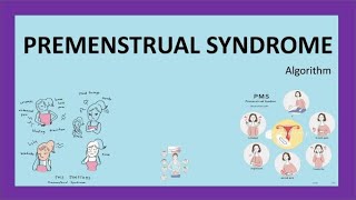 Premenstrual Syndrome Algorithm RCOG Guidelines with important MCQs [upl. by Wasson]