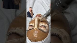 Watch Out BB Glow Facial Could Be Your Beauty Nightmare [upl. by Idyh]