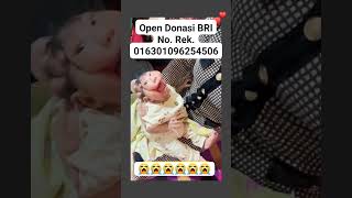 BAYI AJAIB BAYI VIRAL BAYI ANUGRAH BAYI TERLAHIR TANPA TEMPURUNG KEPALA SUBHANALLAH KUASA ALLAH SWT [upl. by Eniledam286]