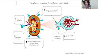 Insuffisance rénale aiguë Socle  L Zafrani [upl. by Nagem]