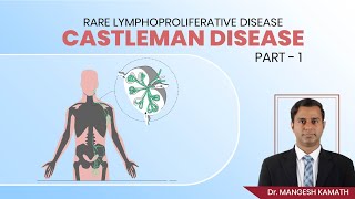 Rare Lymphoproliferative Disease  Castleman Disease Part  1  Dr Mangesh Kamath [upl. by Kilmarx637]