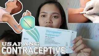 PARA DI AGAD MABUNTIS  IMPLANT EXPERIENCE  family planning methodMy first experience💯 [upl. by Sokil394]