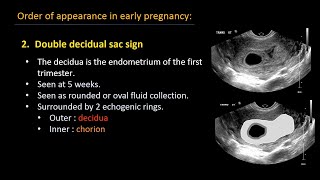 Ultrasound of normal early pregnancy [upl. by Akilaz93]