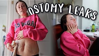 Im Over These Leaks So Im Ordering Different Ostomy Supplies  Lets Talk IBD [upl. by Awram380]