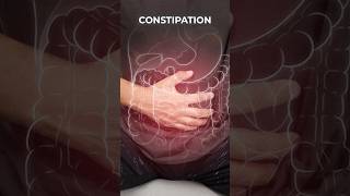 How constipation becomes a big problem for varicose veins and varicocele Simple solution here [upl. by Jacquetta565]