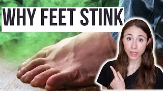 Why Your Feet Stink amp How To Get Rid Of Foot Odor [upl. by Ahsille]