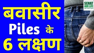 बवासीर Piles के 6 लक्षण 6 Sign and Symptoms Of Piles Bawaseer Ke 6 Lakshan [upl. by Nairolf]