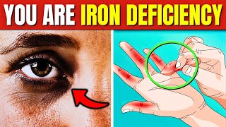 10 ALARMING Signs You Have An Iron Deficiency [upl. by Jeuz]