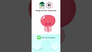 Benign Prostatic Hyperplasia  BNH M Centre [upl. by Unity647]