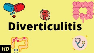 Diverticulitis Causes SIgns and Symptoms Diagnosis and Treatment [upl. by Reo]