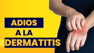 como curar la dermatitis en las manos  remedios caseros para la dermatitis en las manos [upl. by Yatnoed]