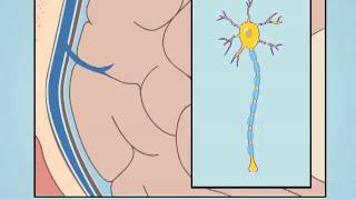 Understanding Diffuse Axonal Injury [upl. by Garfield987]