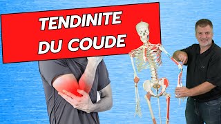 Douleurs au coude  tendinite tennis elbow ou épicondylite Traitements massages et exercices [upl. by Shelburne]