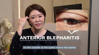 Do I Need To See A Doctor For A Swollen Eyelid  Dr Stephanie Young [upl. by Aeriell]