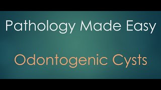 Pathology Made Easy  Odontogenic Cysts [upl. by Olra]