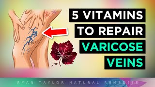 5 Vitamins For Venous Insufficiency VARICOSE Veins Remedies [upl. by Kelwin766]