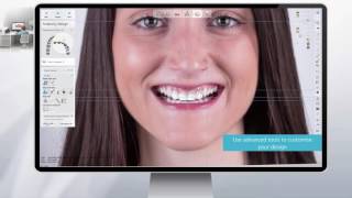 3Shape RealView™ Engine  Next Generation 3D Digital Smile Design [upl. by Ylehsa]