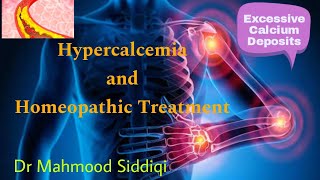 Hypercalcemia in Homeopathy [upl. by Gaul]