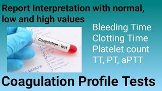 Report Interpretation of Coagulation profile [upl. by Ennaej]