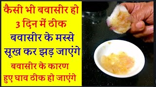 bawasir ka gharelu elaj in hindi बवासीर कैसे ठीक करें bawasir ke liye deshi nuskhadawai upaye [upl. by Lednyc]