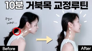 딱 10분 거북목 버섯증후군이 있다면 이 운동 제발 하셔야 합니다 일자목 거북목 스트레칭 버섯증후군교정운동 [upl. by Koeppel]