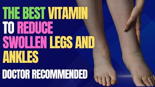 The Best Vitamin to Reduce Swollen Legs and Ankles – Doctor Recommended [upl. by Etaner]