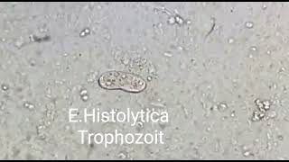 Trophozoite of Entamoeba histolytica [upl. by Enailil]