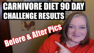 Carnivore Diet 90 Day Weight Loss Results  Before and After pics [upl. by Anesor]